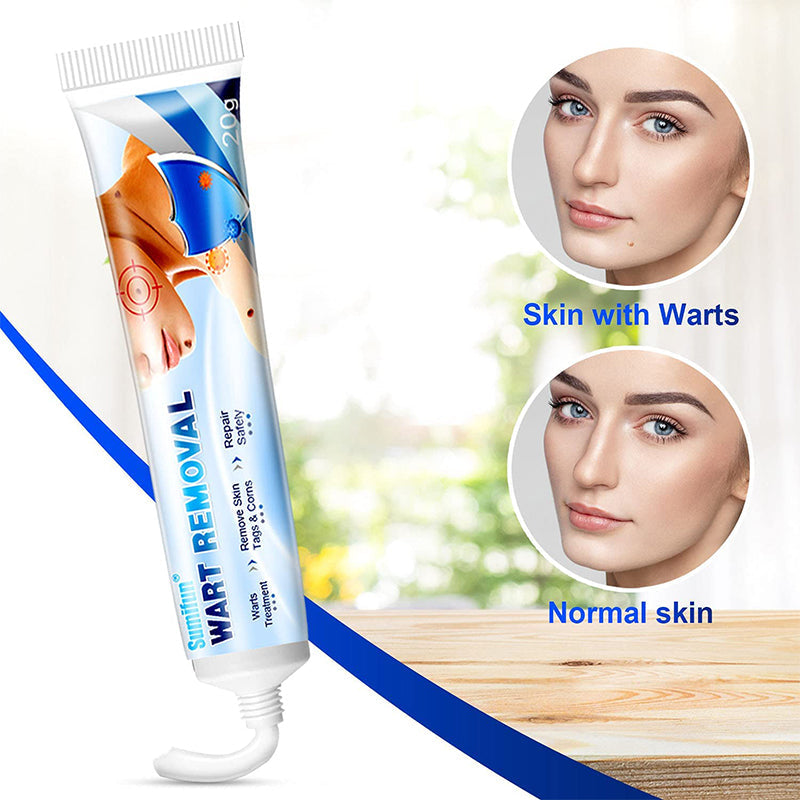 Wart Removal Ointment